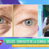 ¿TIENES PÁRPADOS CAÍDOS O BOLSAS BAJO LOS OJOS?