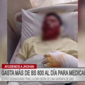 Joven de El Alto sufre explosión con garrafa y su familia solicita apoyo solidario